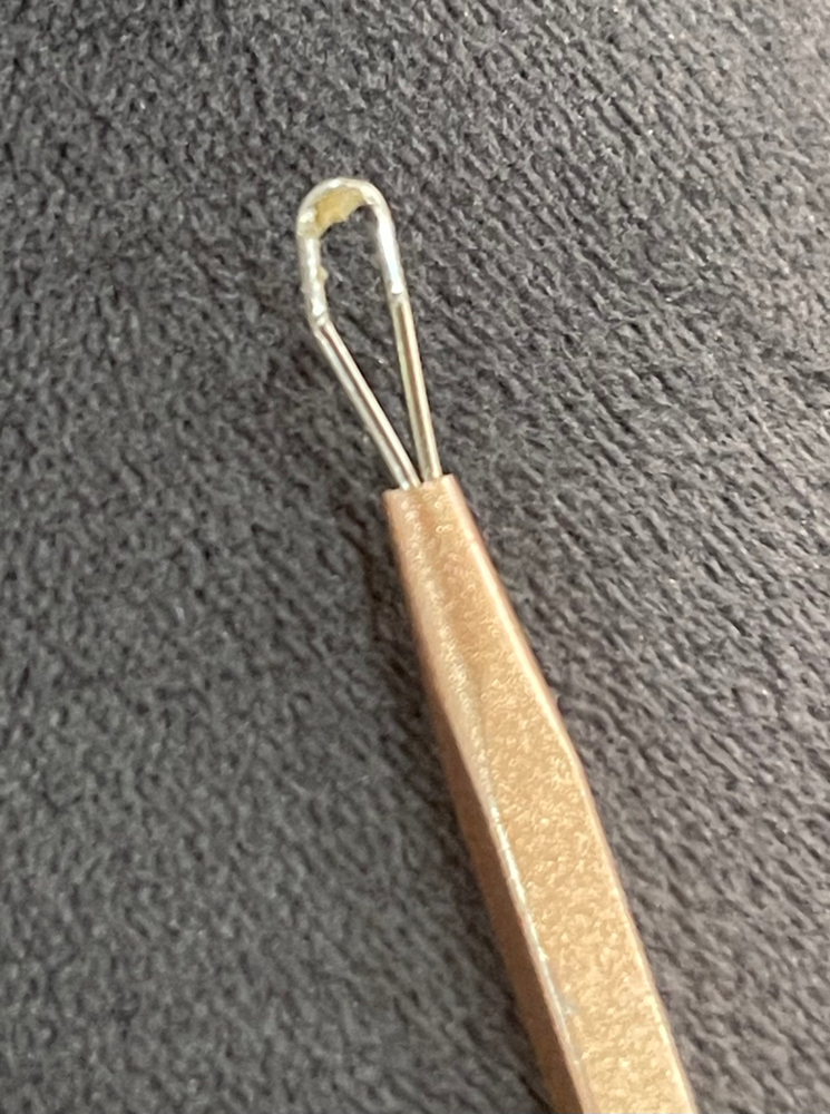 Additional Extractions