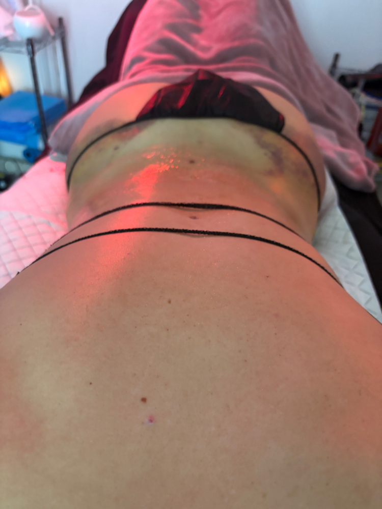 Individual Post-Op Session