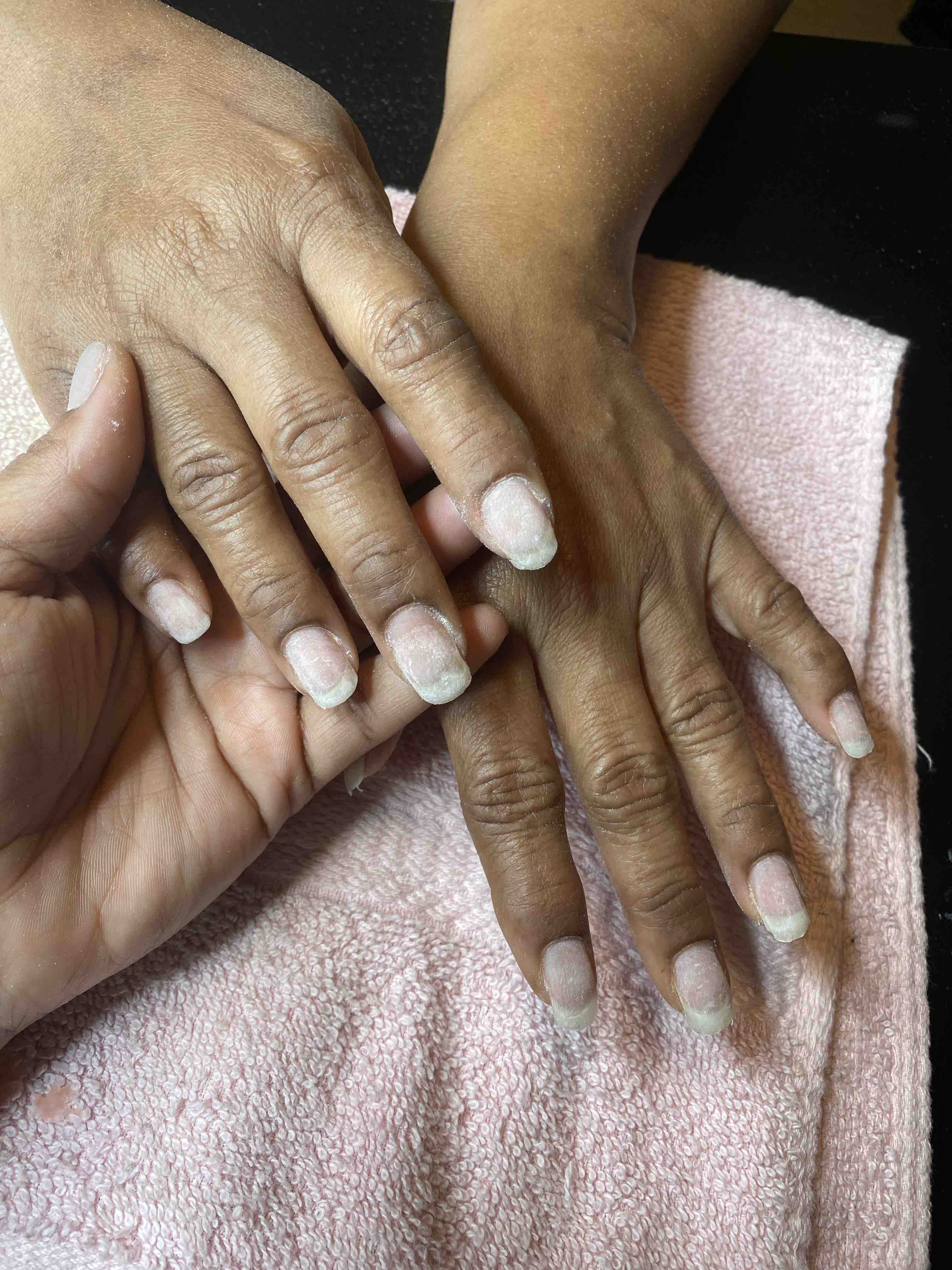 Nail Removal