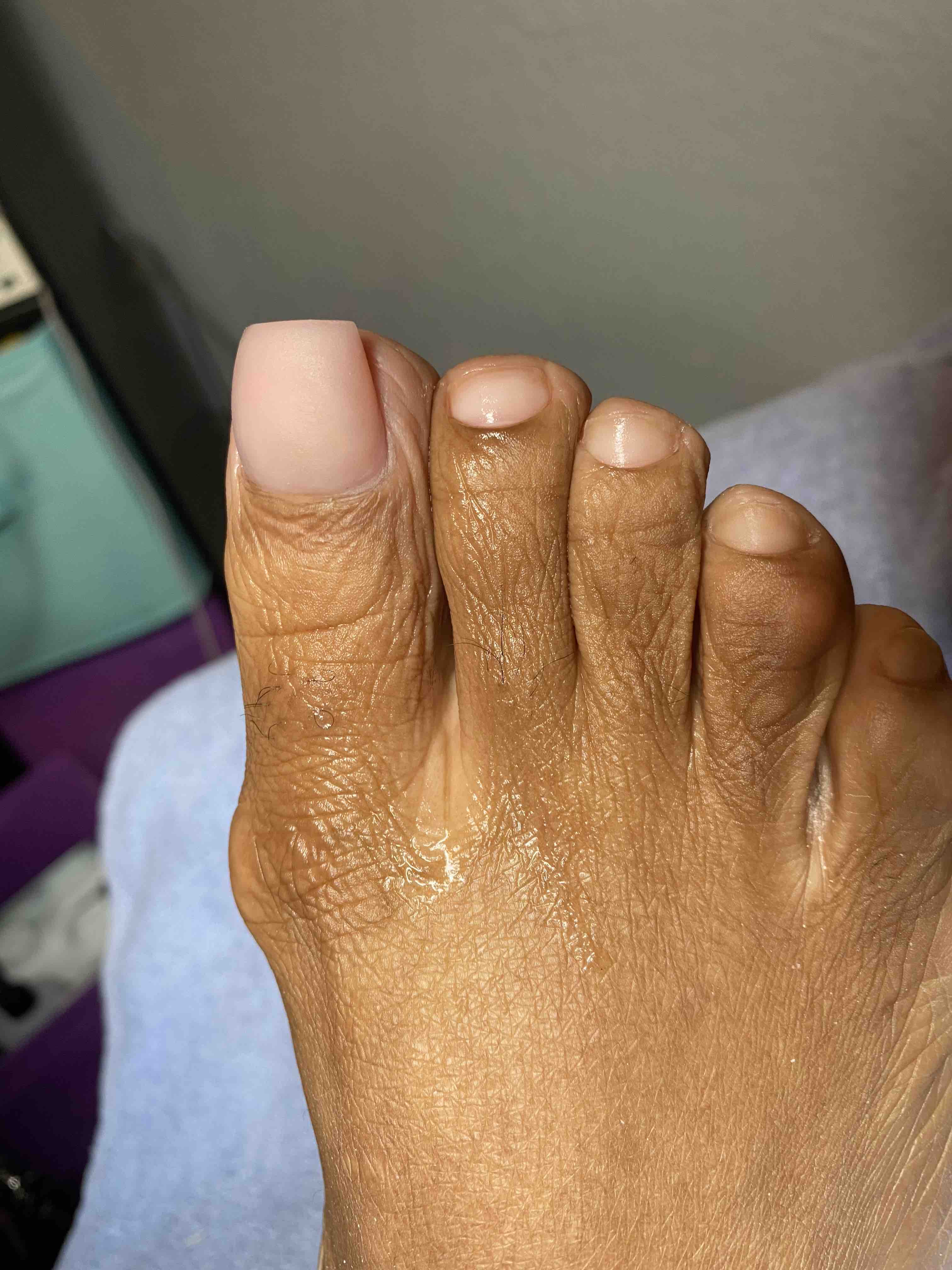 Toe Tip Fill