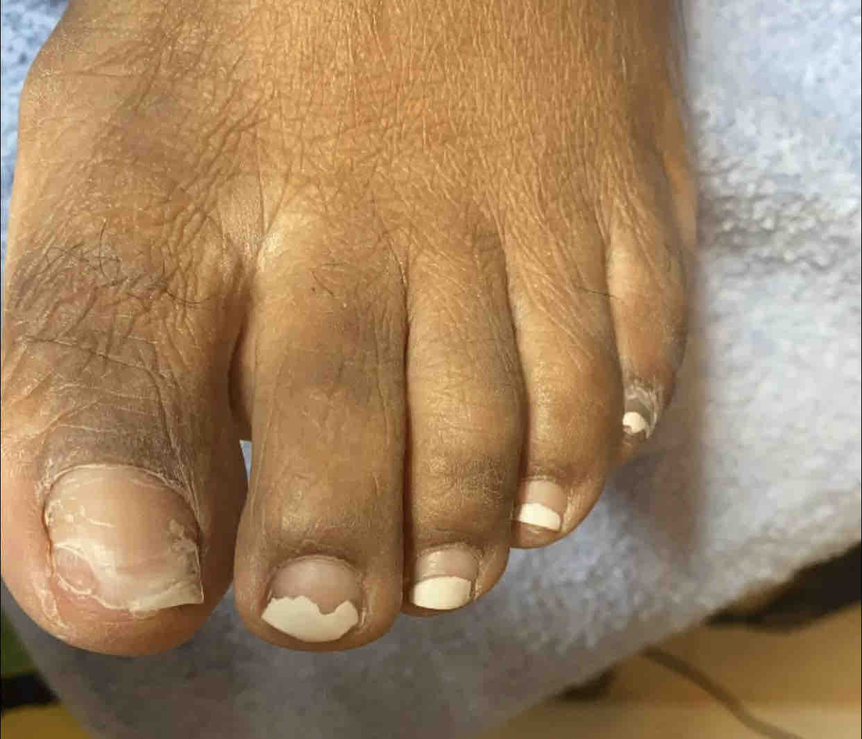 Toe Tip