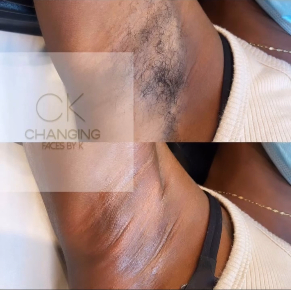 Underarm Wax