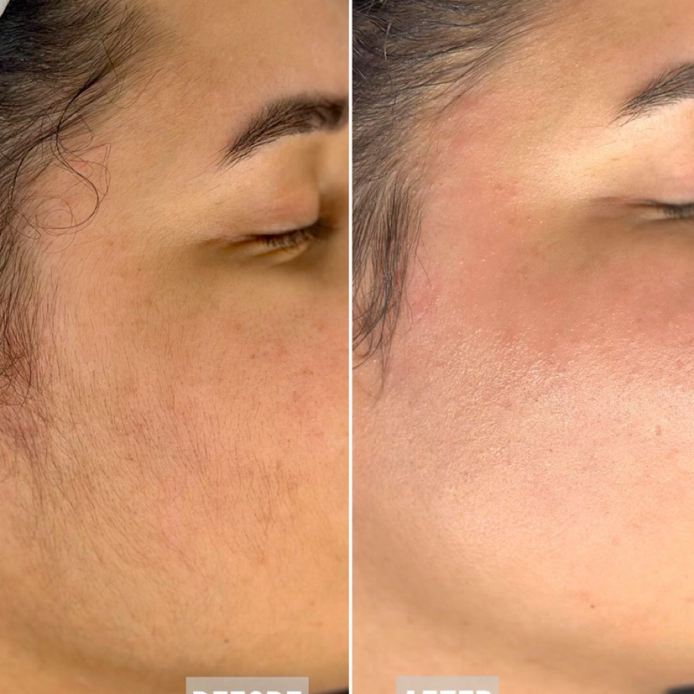 Full Face Wax at BR_BEAUTY in Corpus Christi, TX