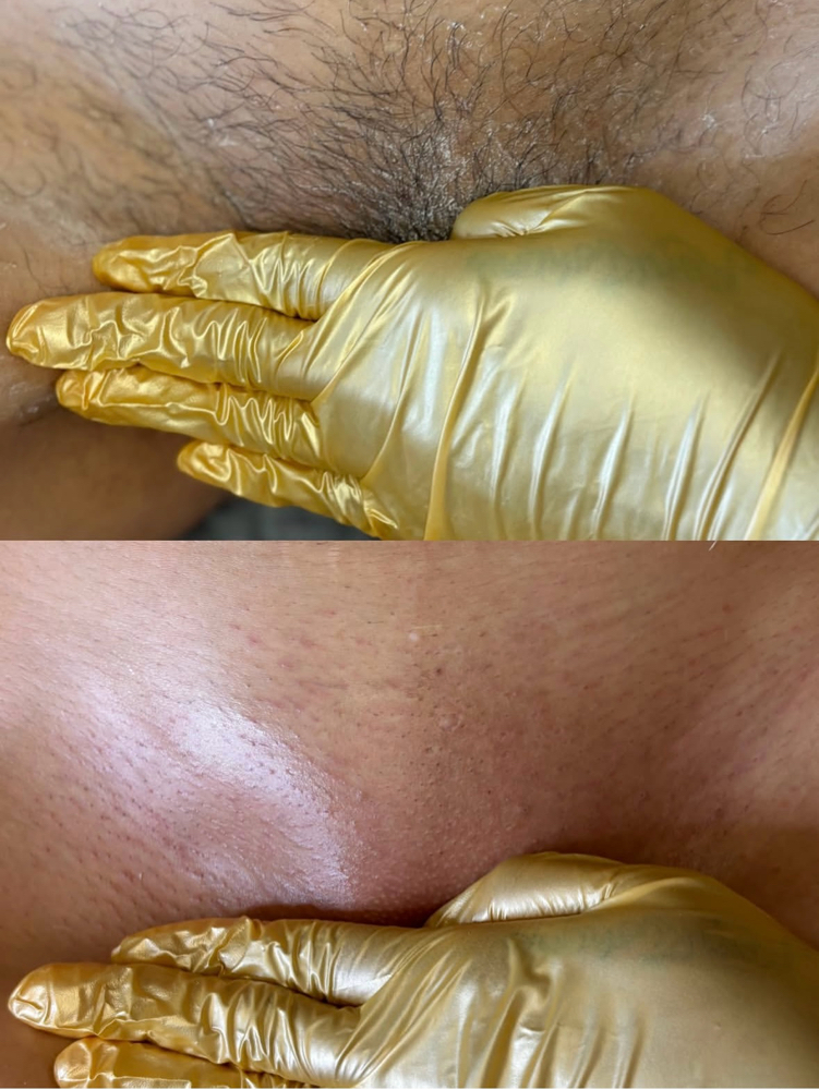 New Client Braz Wax
