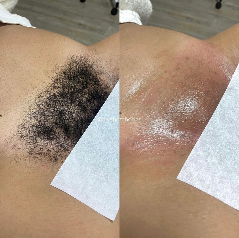 4+ Week Brazilian