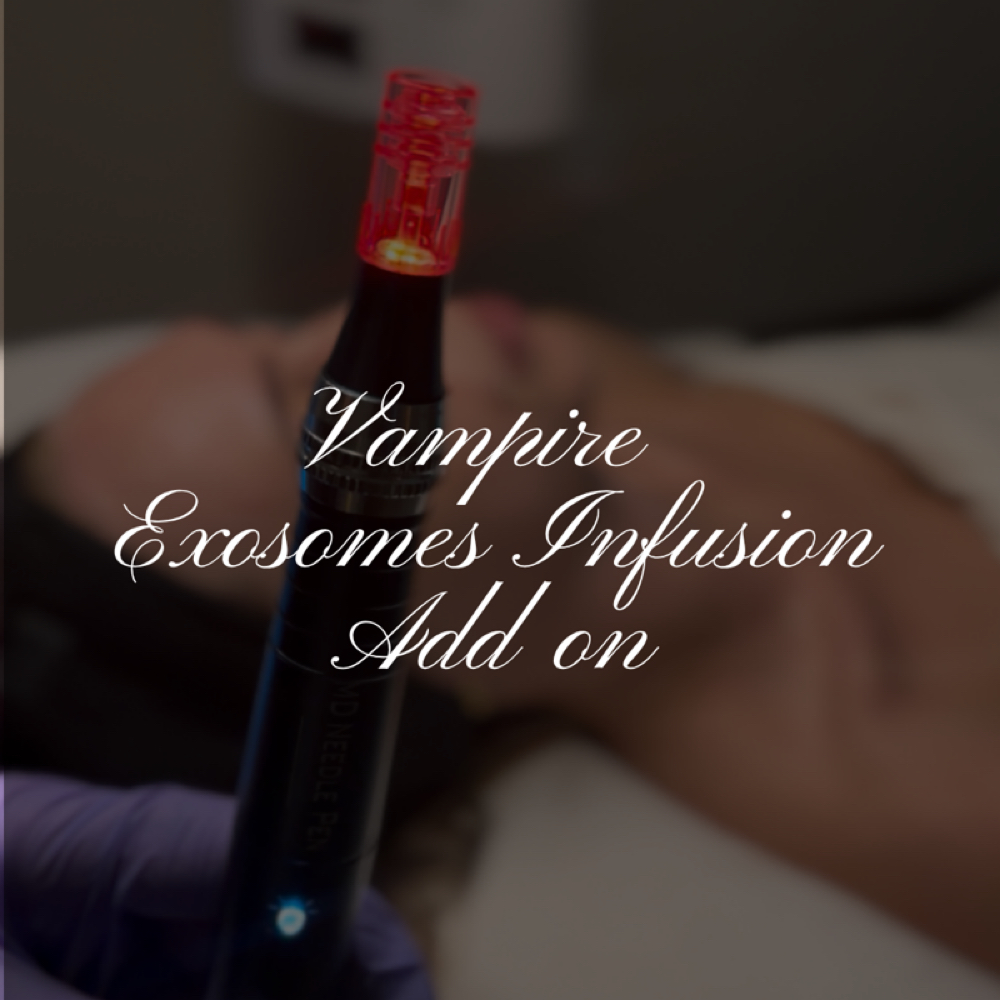 Vampire Exosomes Infusion Add On at ASH Beauty & Wellness in Cumberland, MD