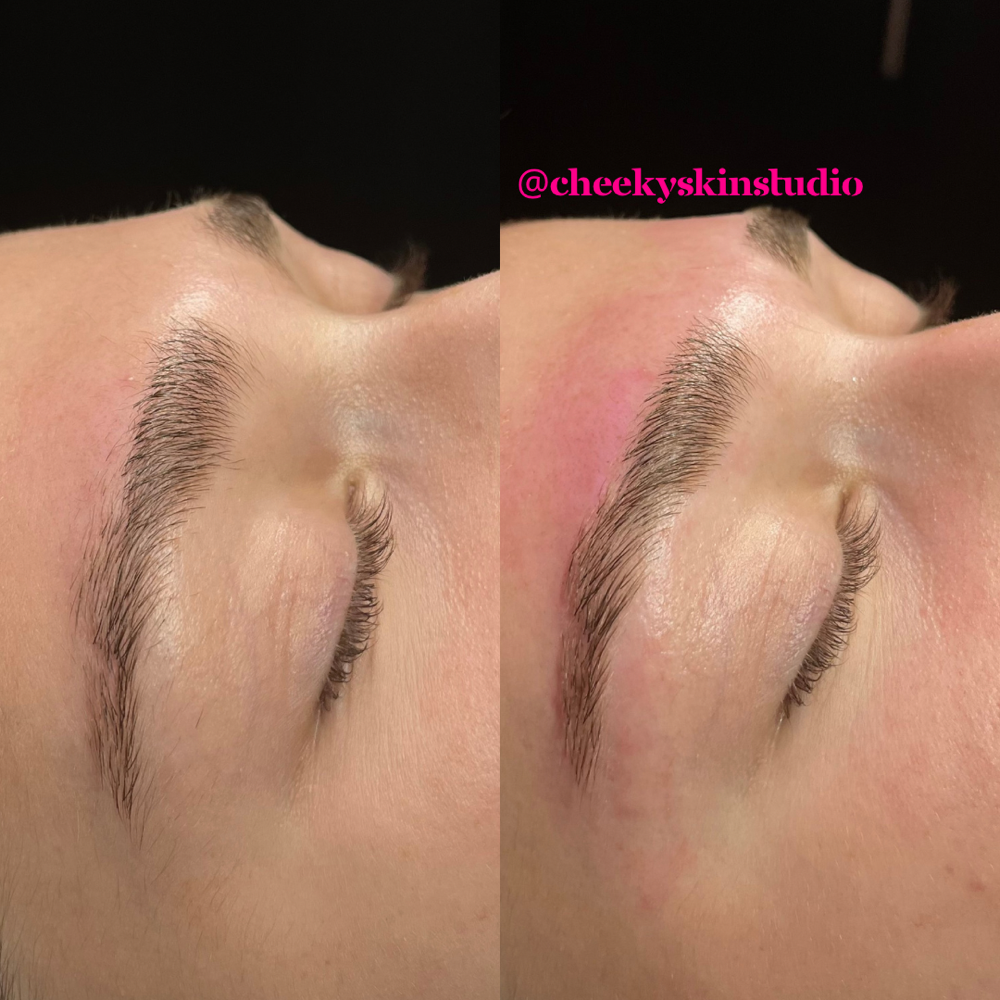 Brow Clean Up