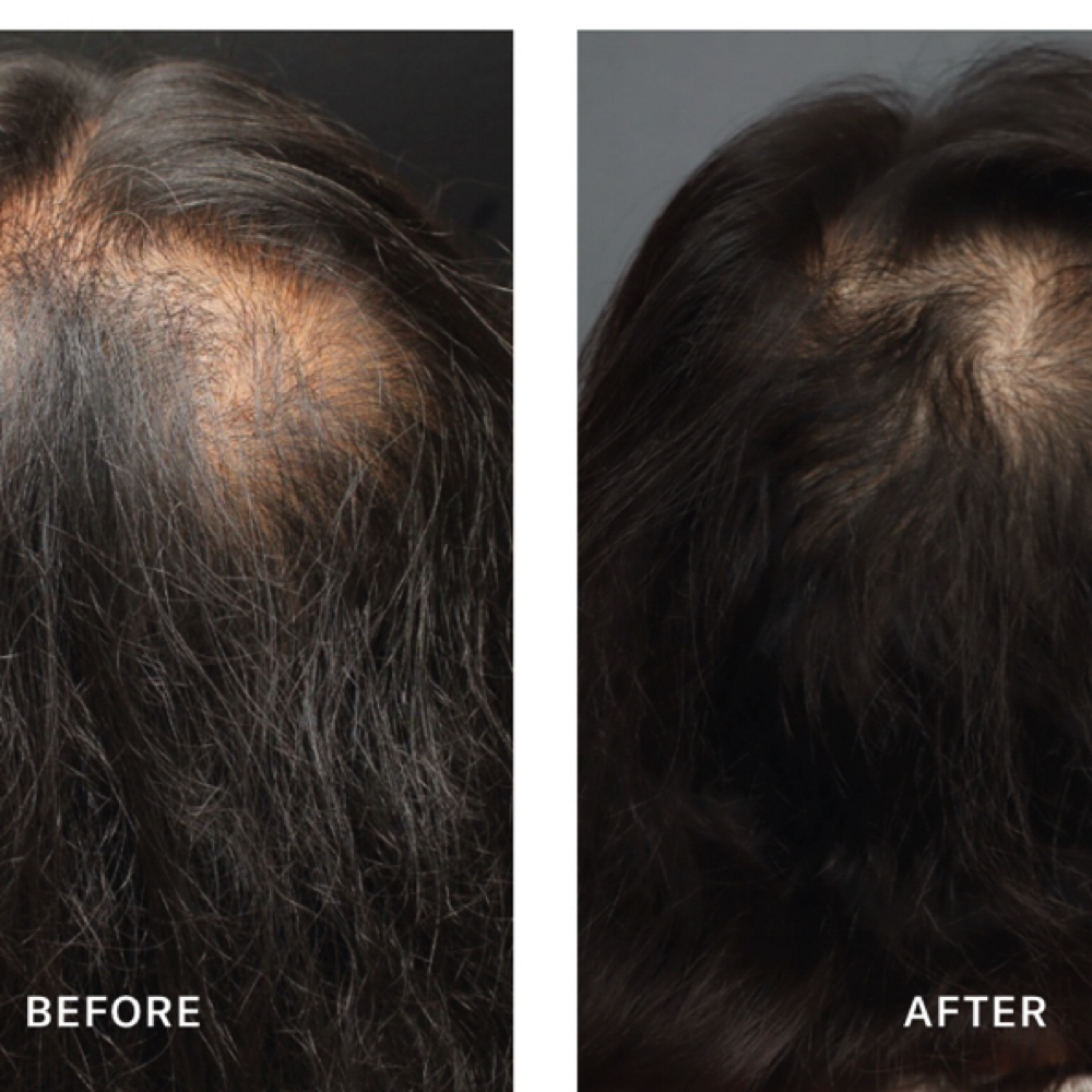 Hair Restoration & Scalp Wellness at Sugarbakers Salon in Inverness, FL