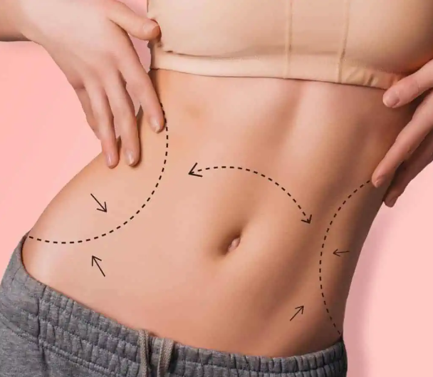 Body Sculpting at Monarca Latina Beauty Spa in McAllen, TX