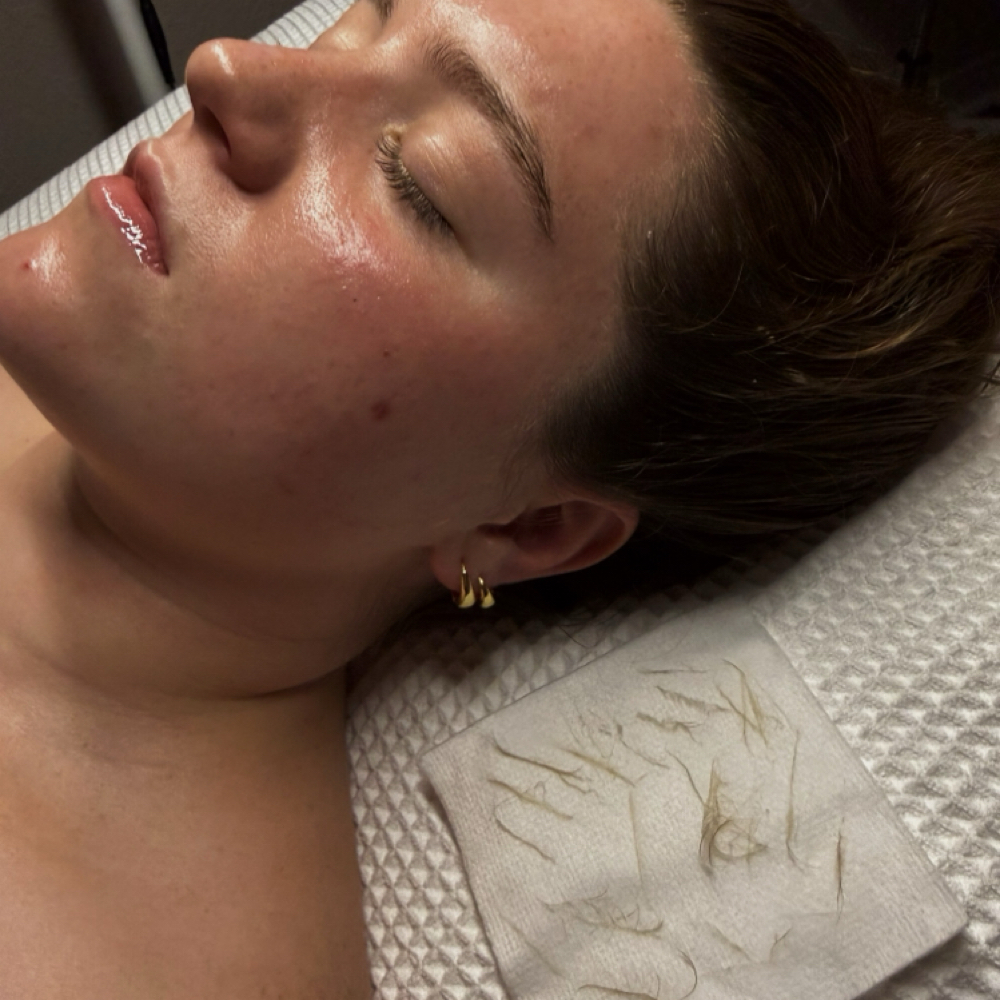 Halo dermaplane Facial at Halo Aesthetics in PLYMOUTH, WI