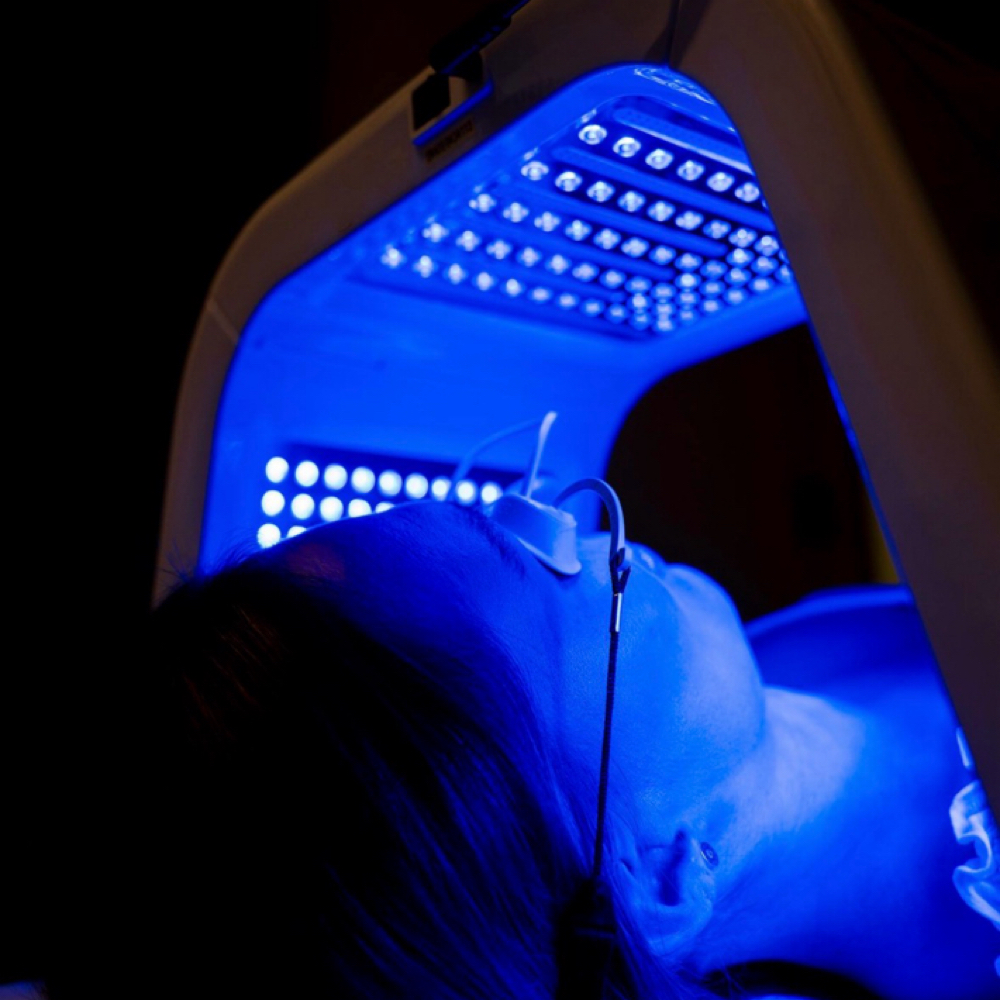 Acne Facial at Jspa Aesthetics in West Islip, NY