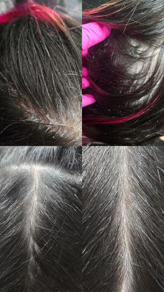 The Scalp Revival Service