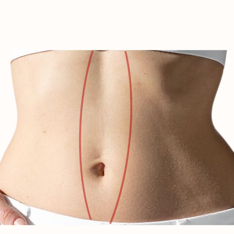 Stomach Strip at Bareline Aesthetics in Brea, CA