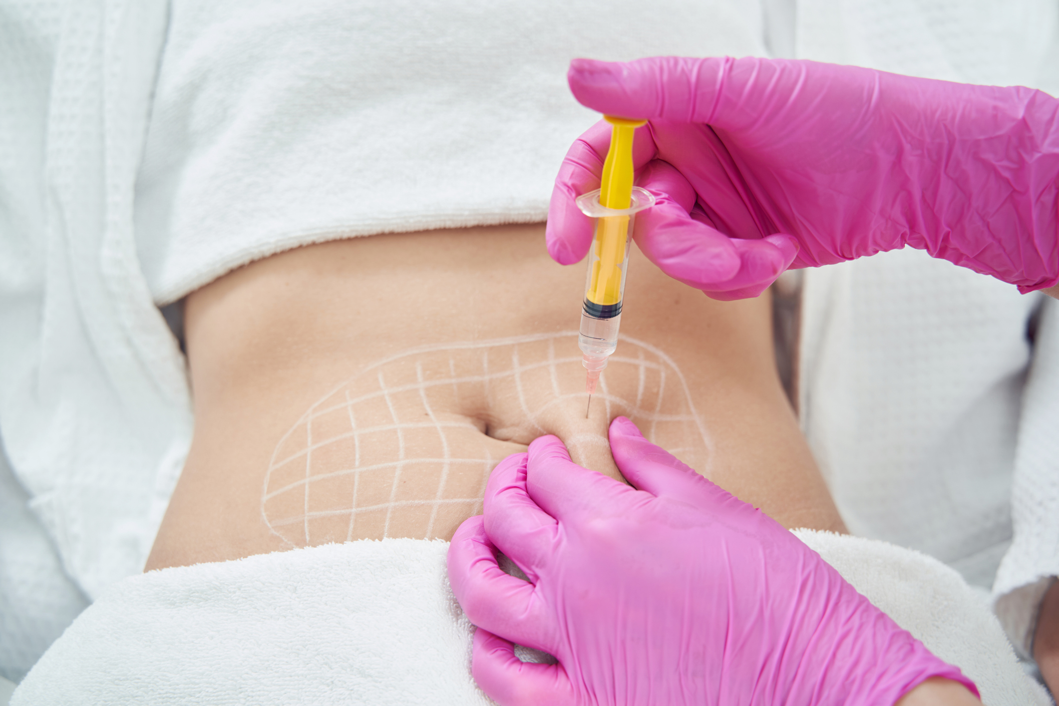 6 Treatments-2 Areas Max