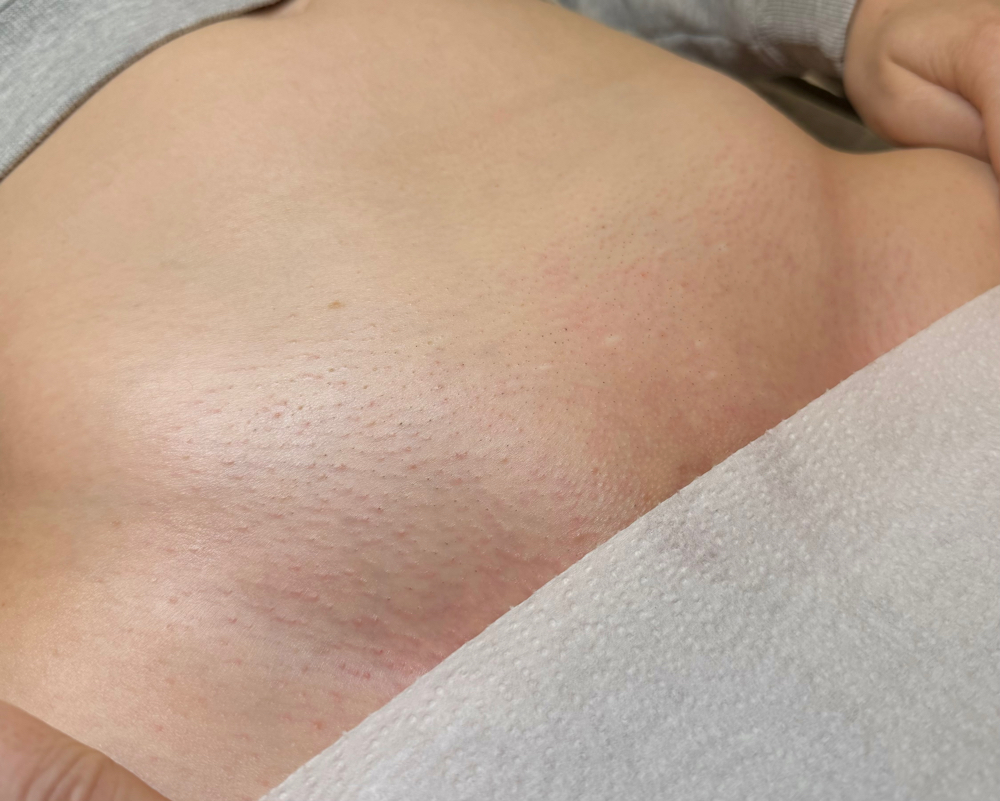 Brazilian Wax