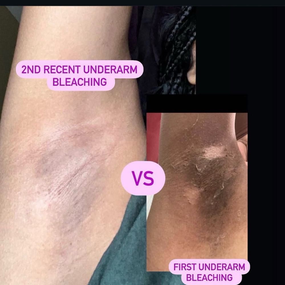 Intimate Skin Lightening at Enchanted Esthetics in Peebles, OH