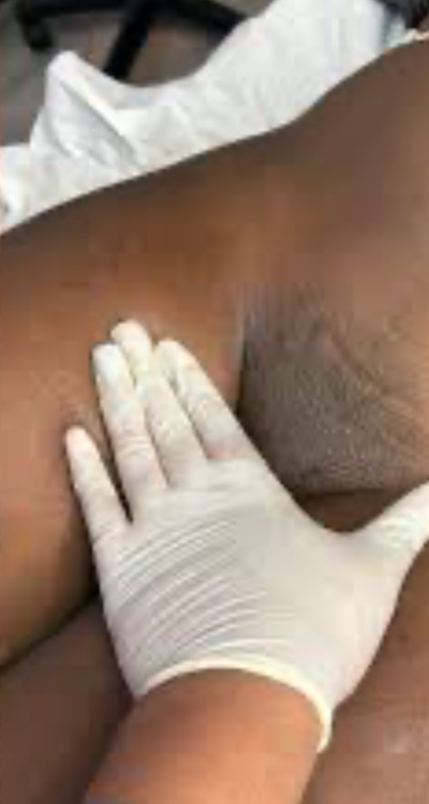 Brazilian