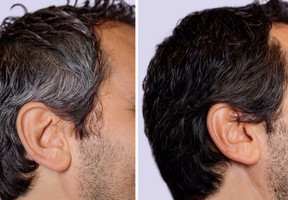 Men’s Root Refresh