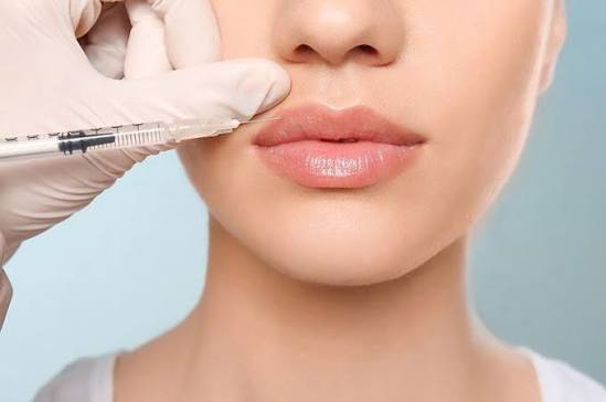 Full Lip at Victoria Sanders, BSN, RN in OKC, OK