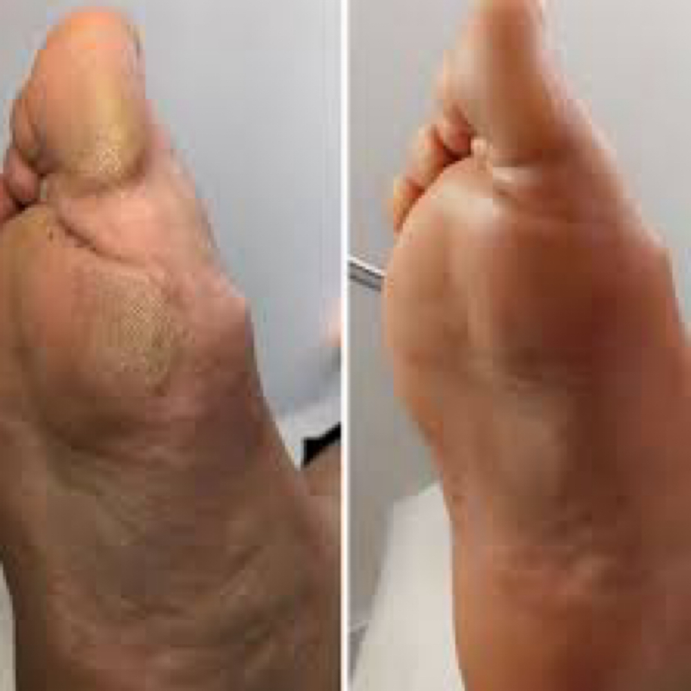 Dry Pedicure at Sachi Nails and Body Spa in Yonkers, NY