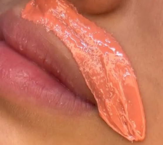 Upperlip, Chin, Nose at Peachy polish in Elgin, IL