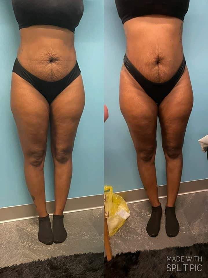 Shape Me Up Session at Beauty by Shaddai in Ocala, FL