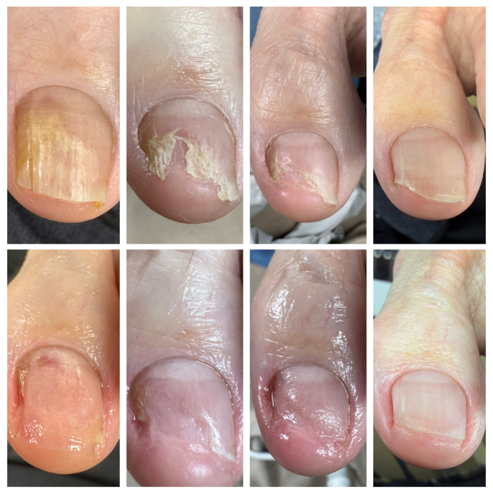 Reconstruction Maintenance at Divine Goddess | Wellness Nail Reconstructions in Spring Hill, FL
