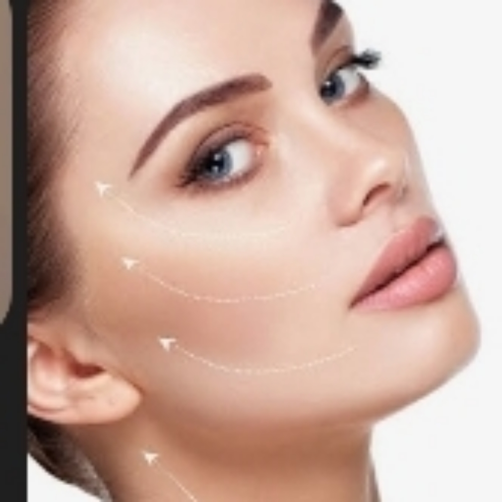 Full Cheek pop at Lavana Medspa in Edinburg, TX