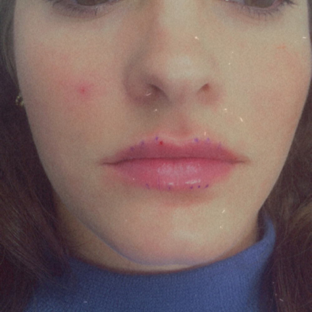 Lip Flip at DopeGirlz Beauty Medical Spa /Academy in Columbus, OH