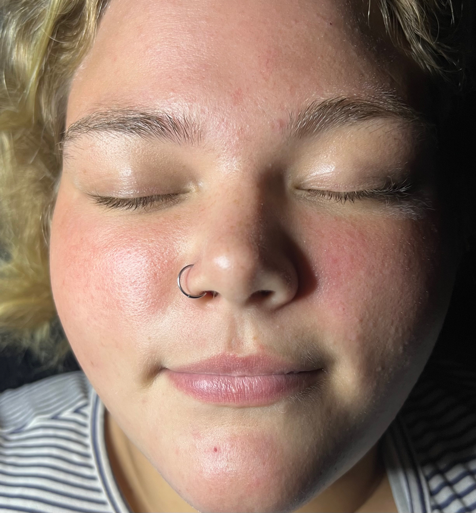 Dermaplaning (add-on)