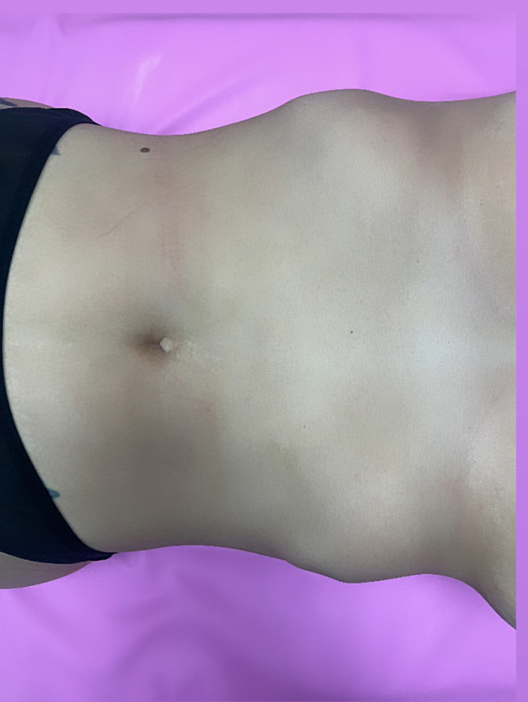 Stomach Wax