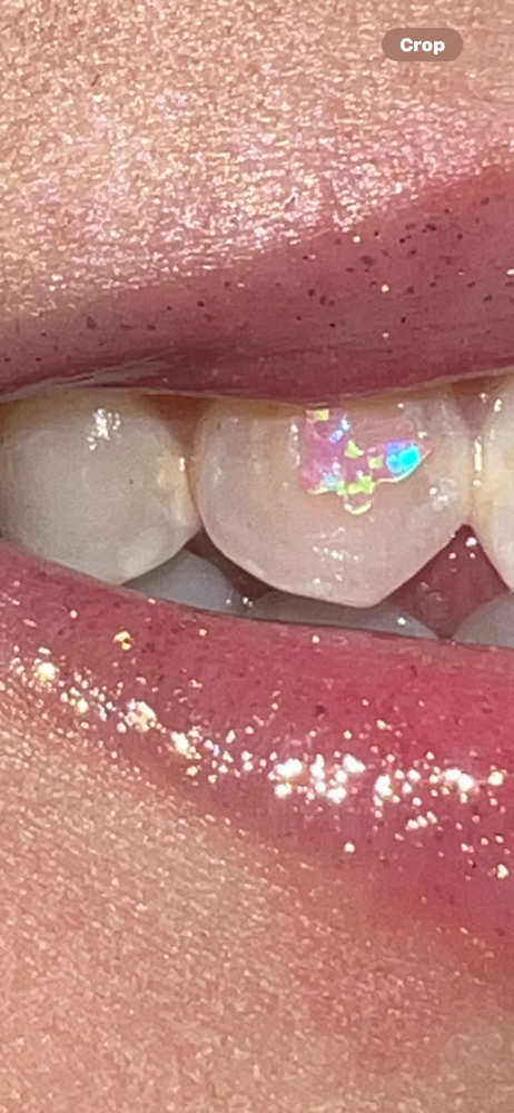 Opal Tooth Gem πβ¨