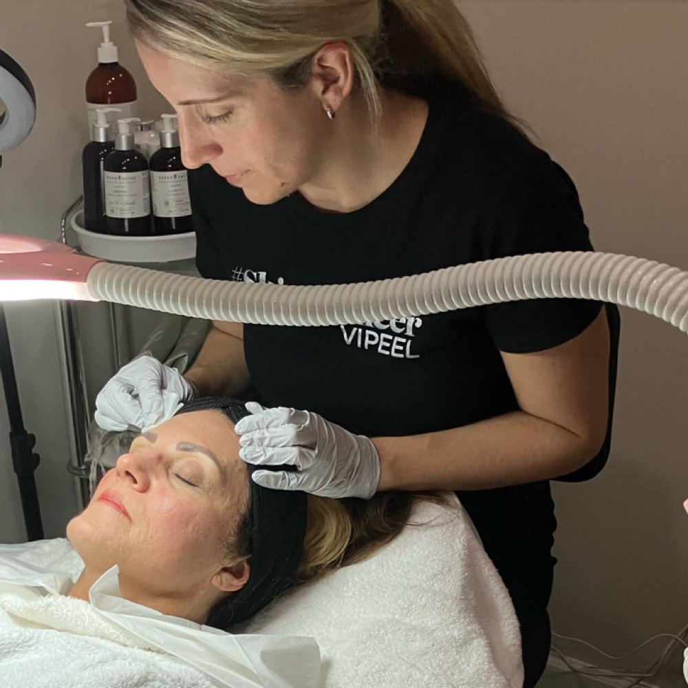 Series Of 3 VI Chemical Peels at Southern Glow Skincare in Augusta, GA