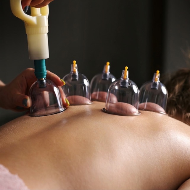 Cupping at Trezure Wellness in Houston, TX