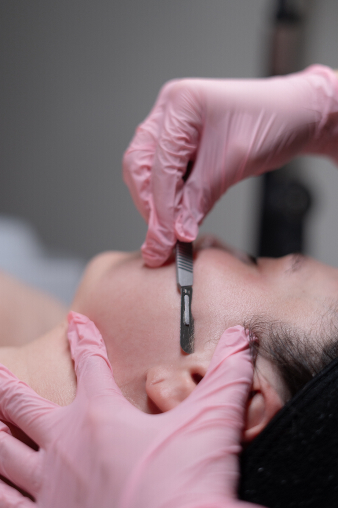 Dermaplane Treatment