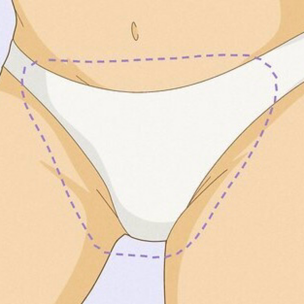 Bikini Line/ Full Waxing at Untamed Radiance in Lanham, MD