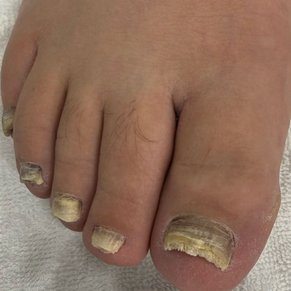 Level 4 – Intensive Foot Care $180 at Rosy’s Mobile Nail Care in Lakeland, FL