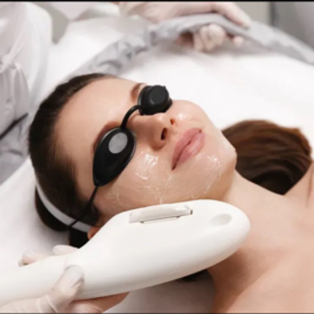 IPL Photo Facial at Empower Aesthetics in Canyon Lake, TX