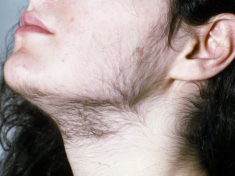 Neck Wax at Eximius Bella in Garner, NC