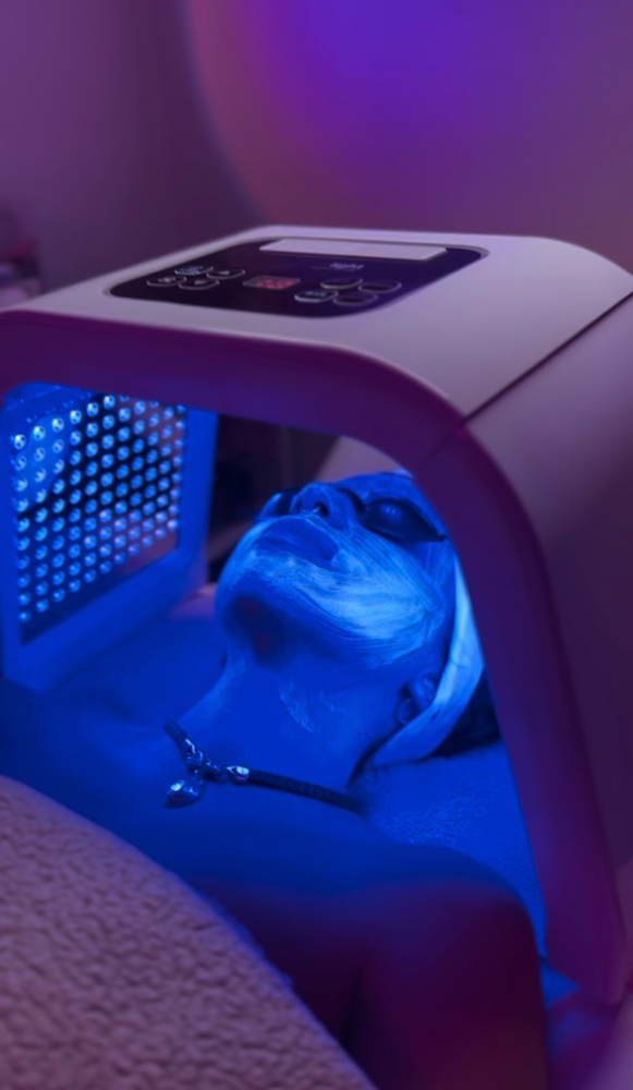 Chemical Peel Facial