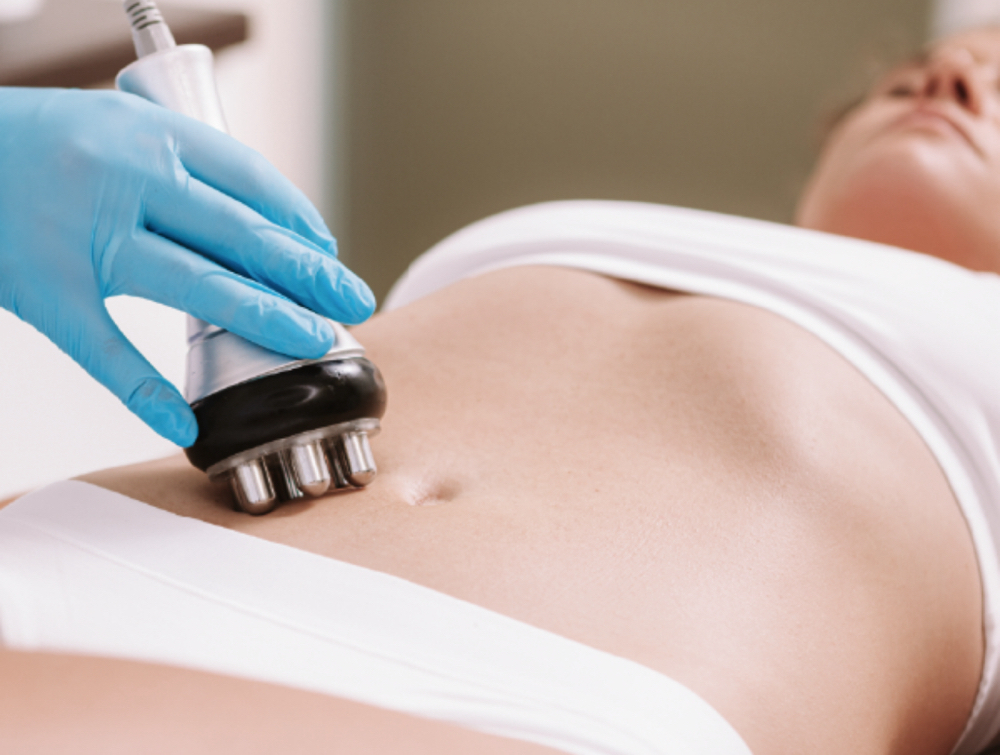 Cavitation And Radio Frequency