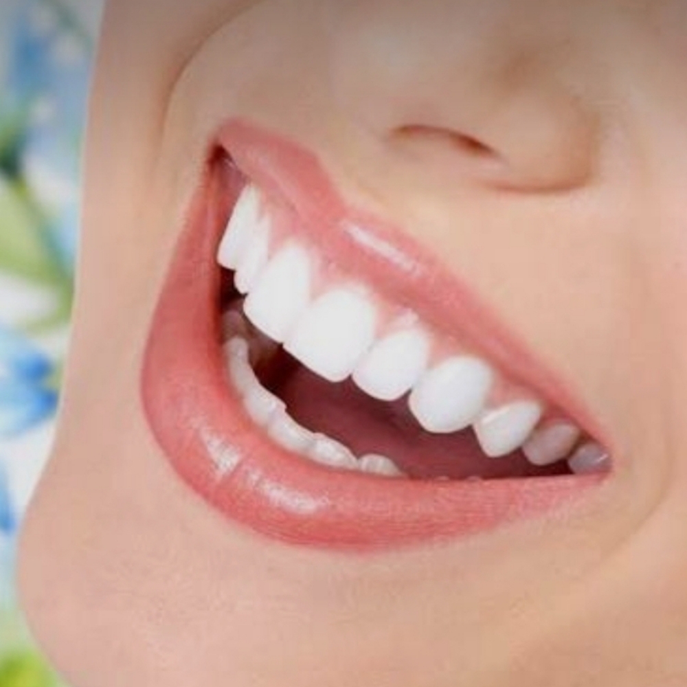 Classic Teeth Whitening at Elysian Luxe in Bakersfield, CA