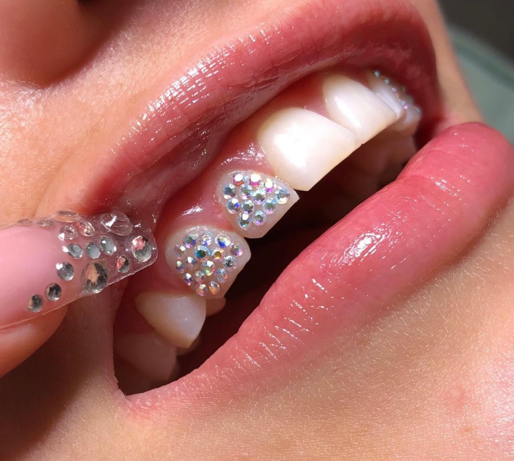 Full Disco Ball Tooth