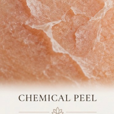 Chemical peel treatment at Vivere Spa in Roseville, CA