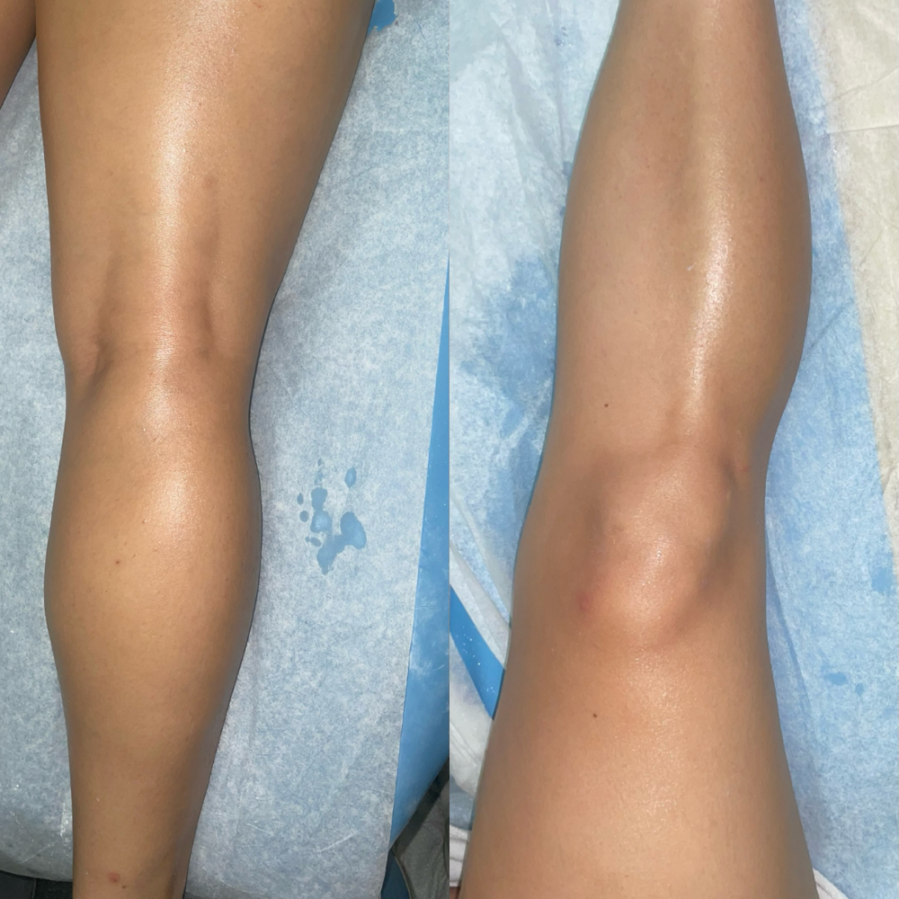 Full Leg Wax