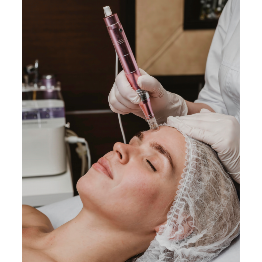 Microneedling at Rei’A Esthetics in Yonkers, NY