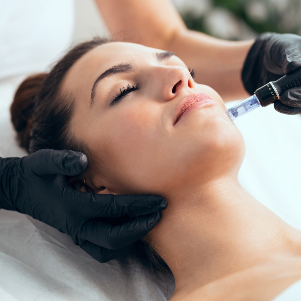 Microneedling Face & Neck