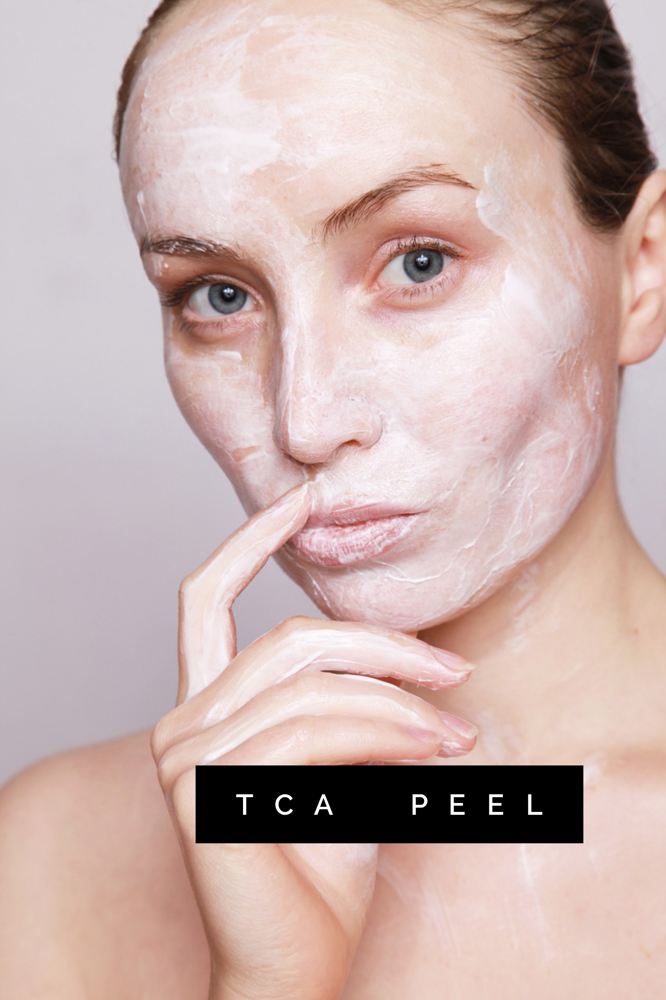 TCA Peel