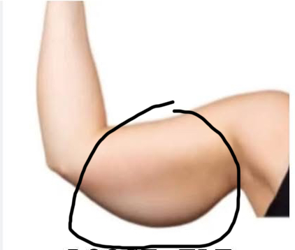 Arm Injections
