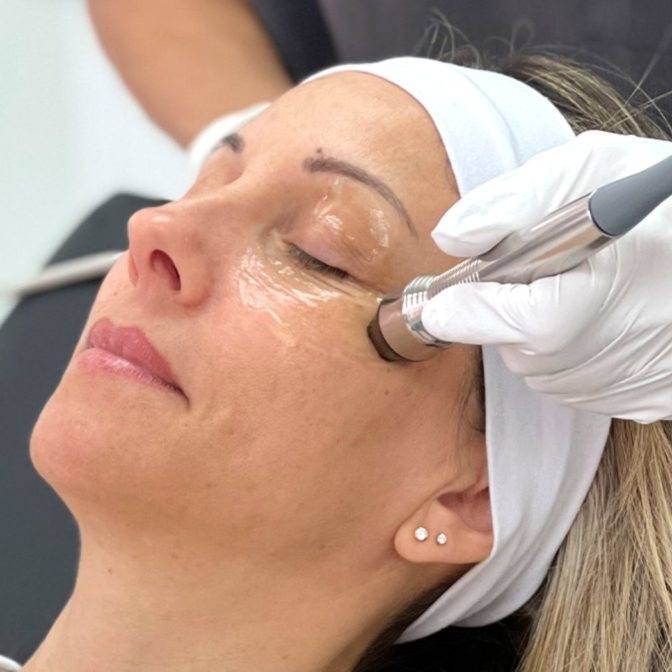 RF Eye Firm at SkinFix Pro in Longwood, FL